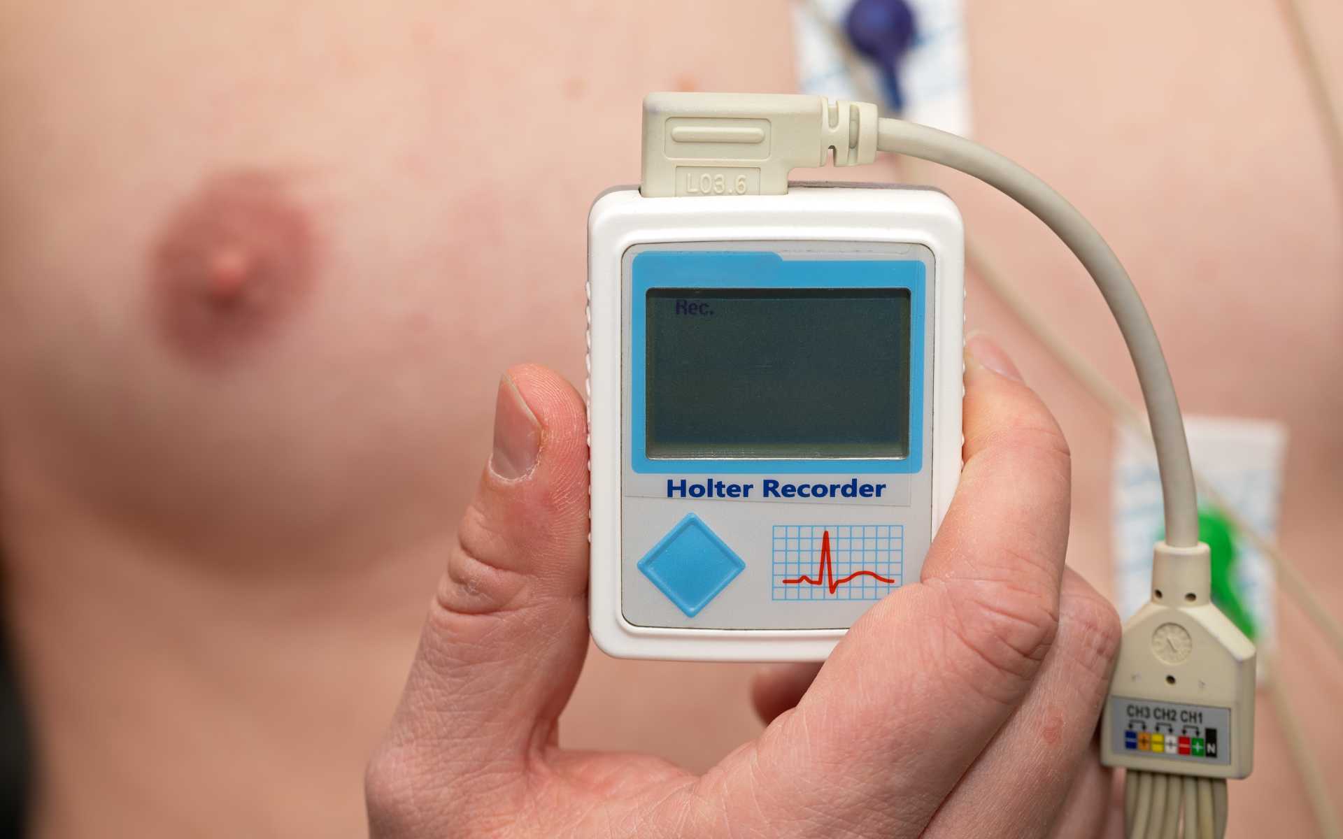 Exames Laboratoriais